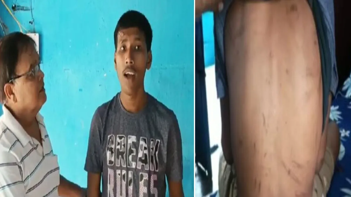 special child tortured- India TV Hindi