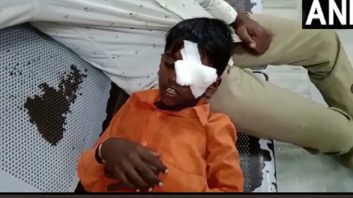 Child injured while lighting firecrackers- India TV Hindi