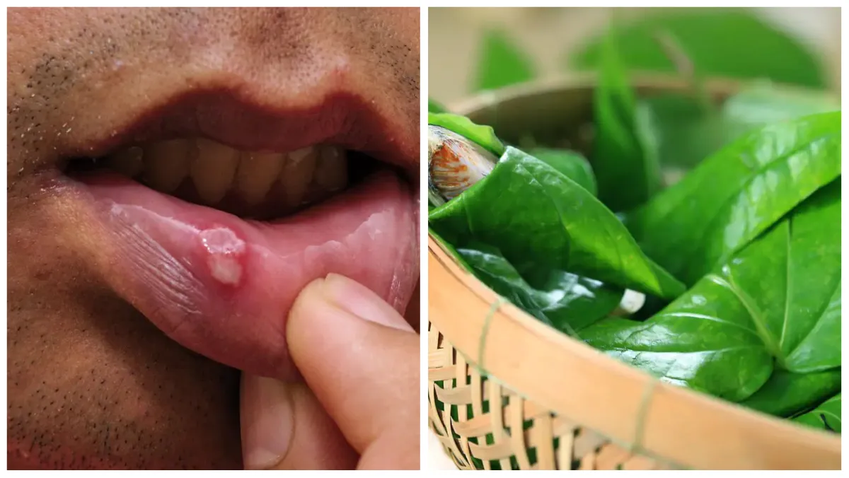 paan_for_mouth_ulcers- India TV Hindi