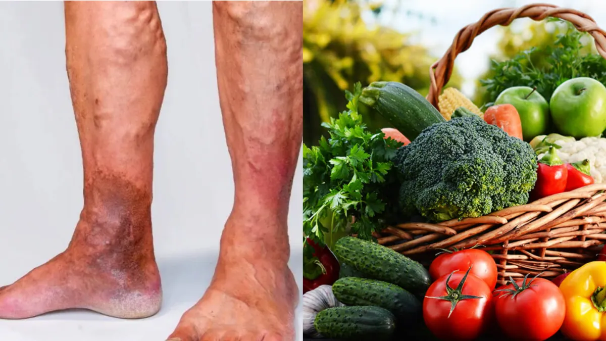 vegetables_for_varicose veins- India TV Hindi