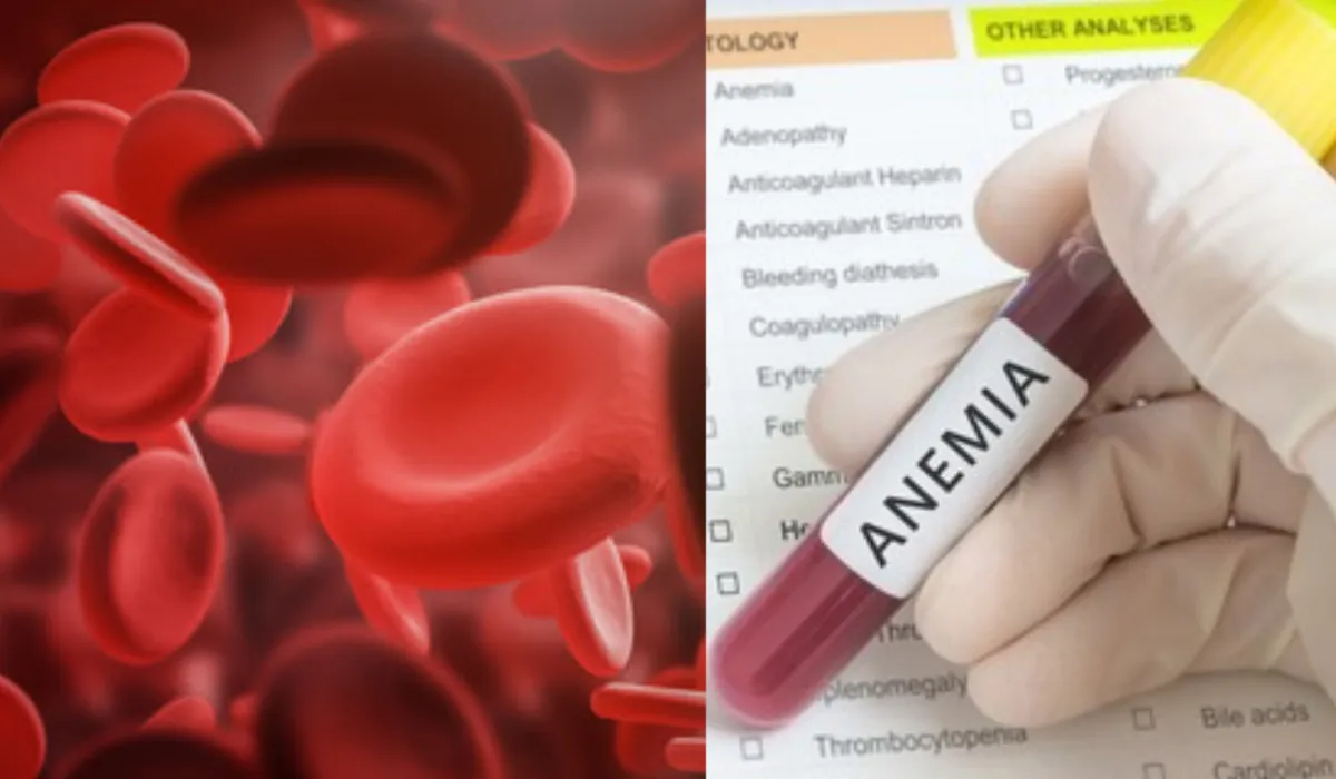 try these home remedies for anemia in hindi, - India TV Hindi