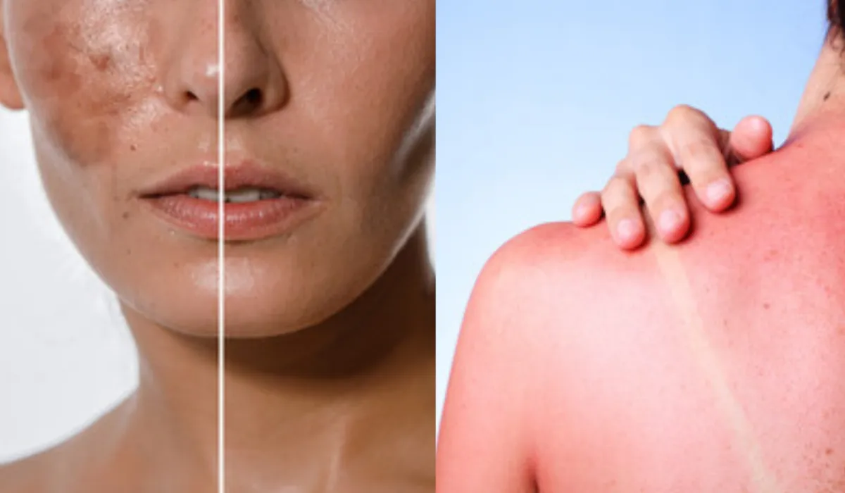 skin care tips - India TV Hindi