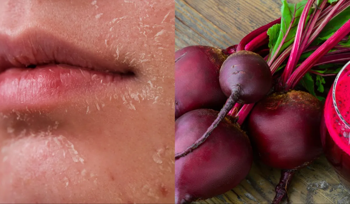 Beetroot for skin- India TV Hindi