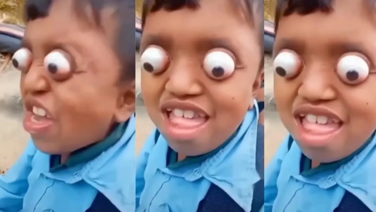 You will be stunned to see the eyes of a child- India TV Hindi