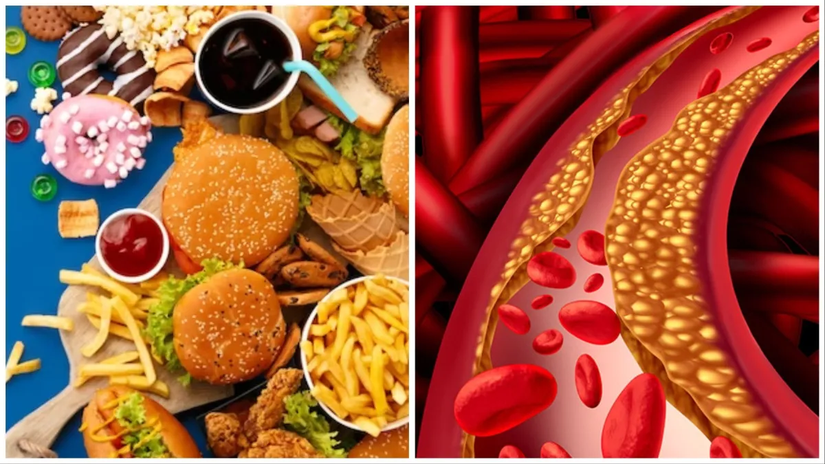 What increases cholesterol quickly- India TV Hindi