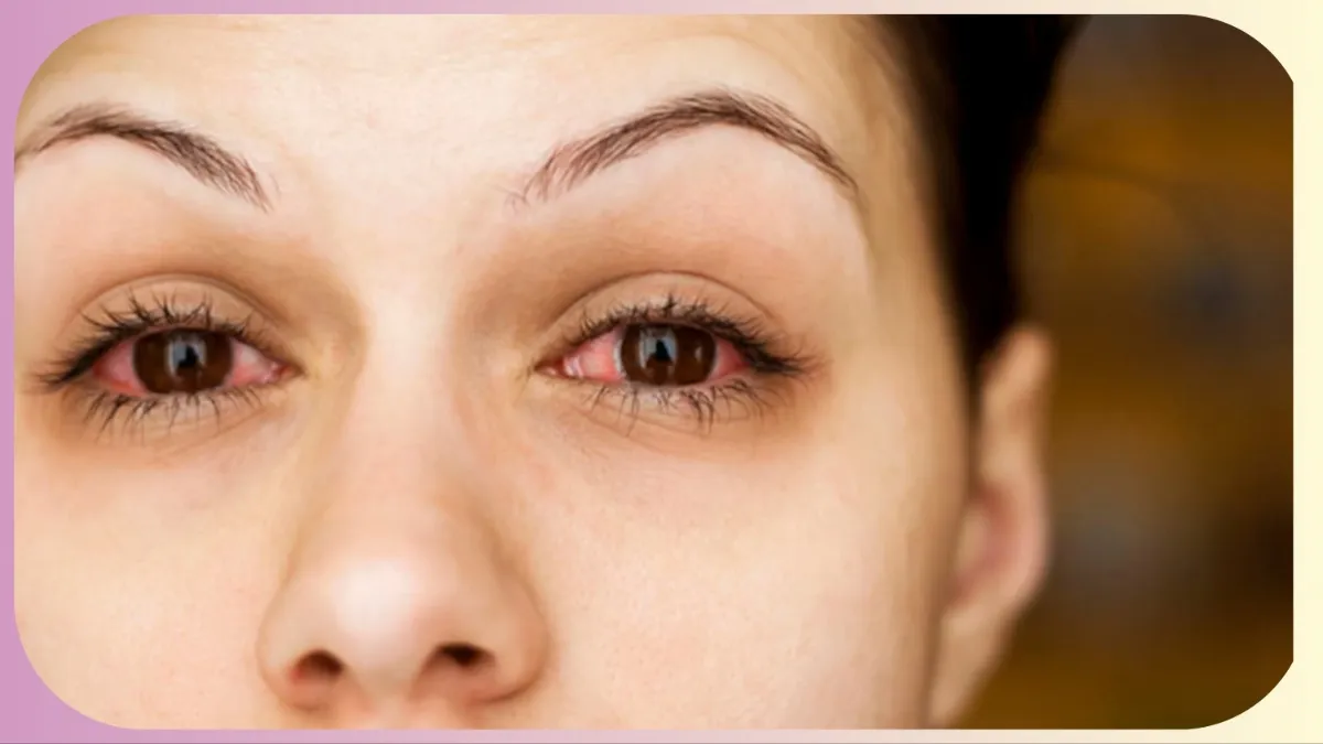 Conjunctivitis- India TV Hindi