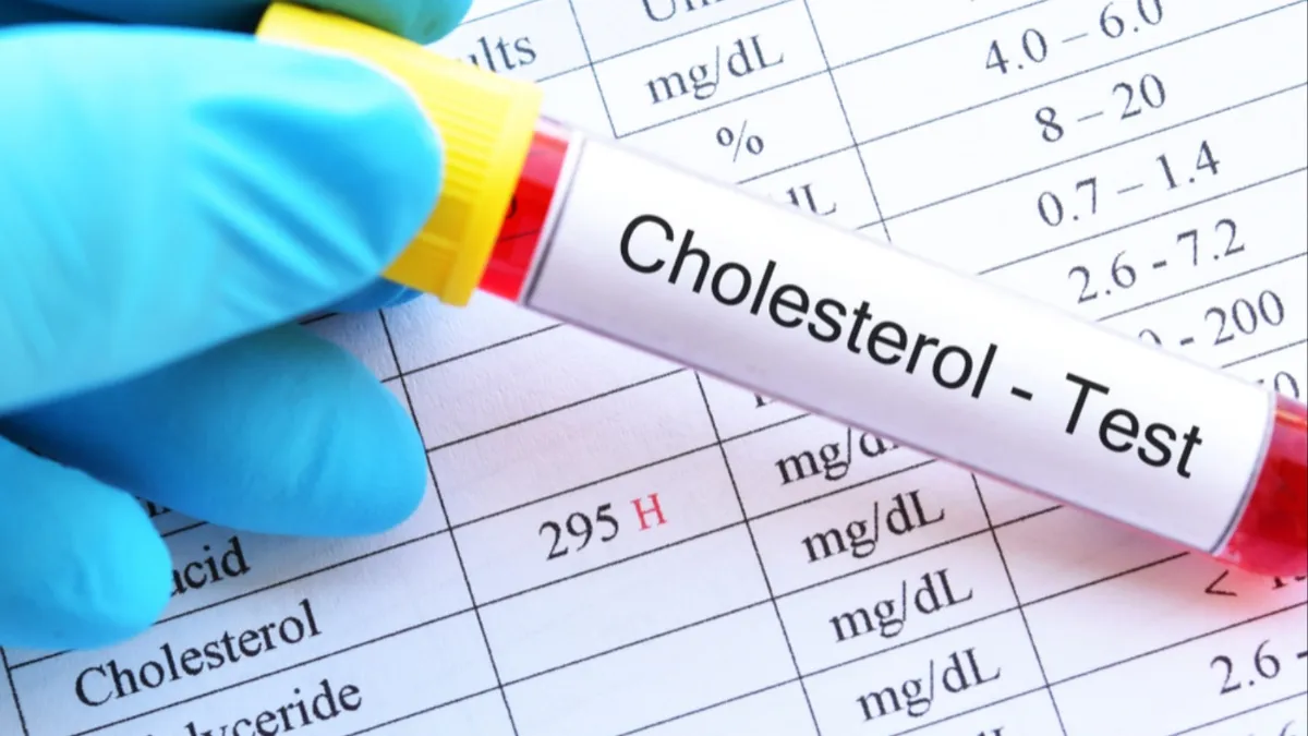 Cholesterol test- India TV Hindi