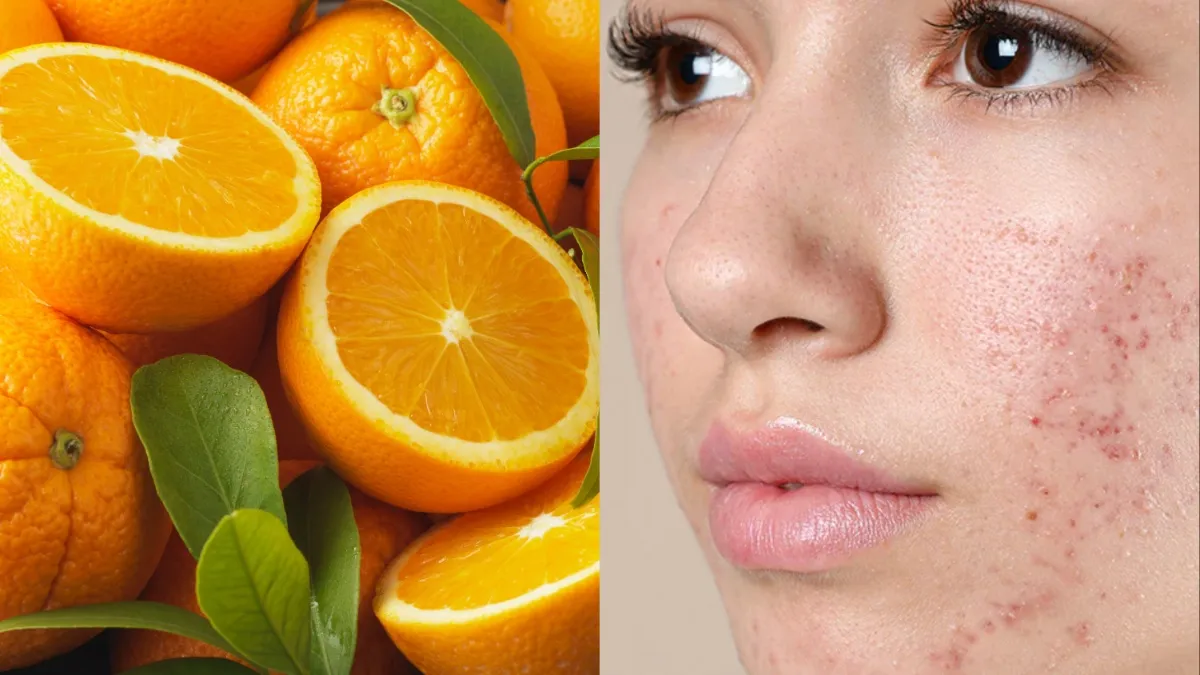 Orange benefits for oily skin- India TV Hindi