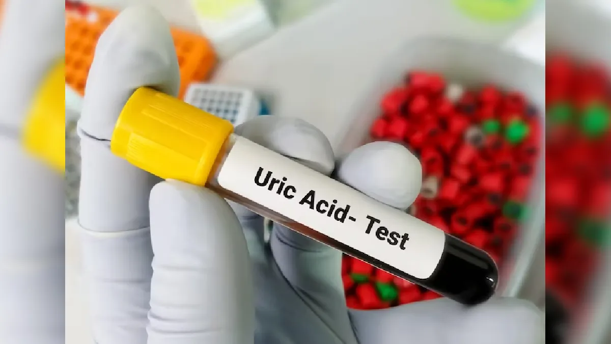 home remedy for uric acid- India TV Hindi