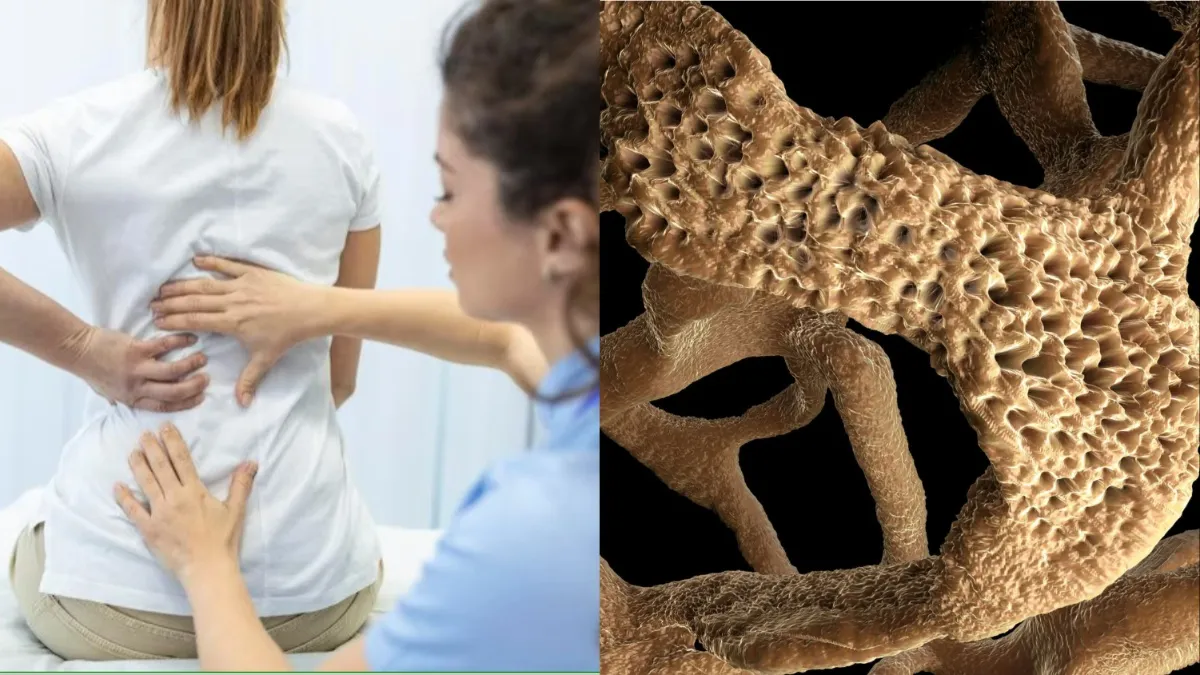 bone affected by osteoporosis - India TV Hindi