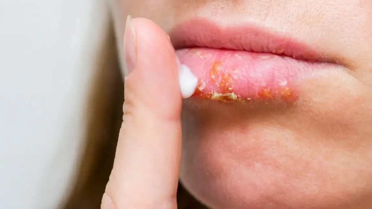  Home remedies for dry lips- India TV Hindi