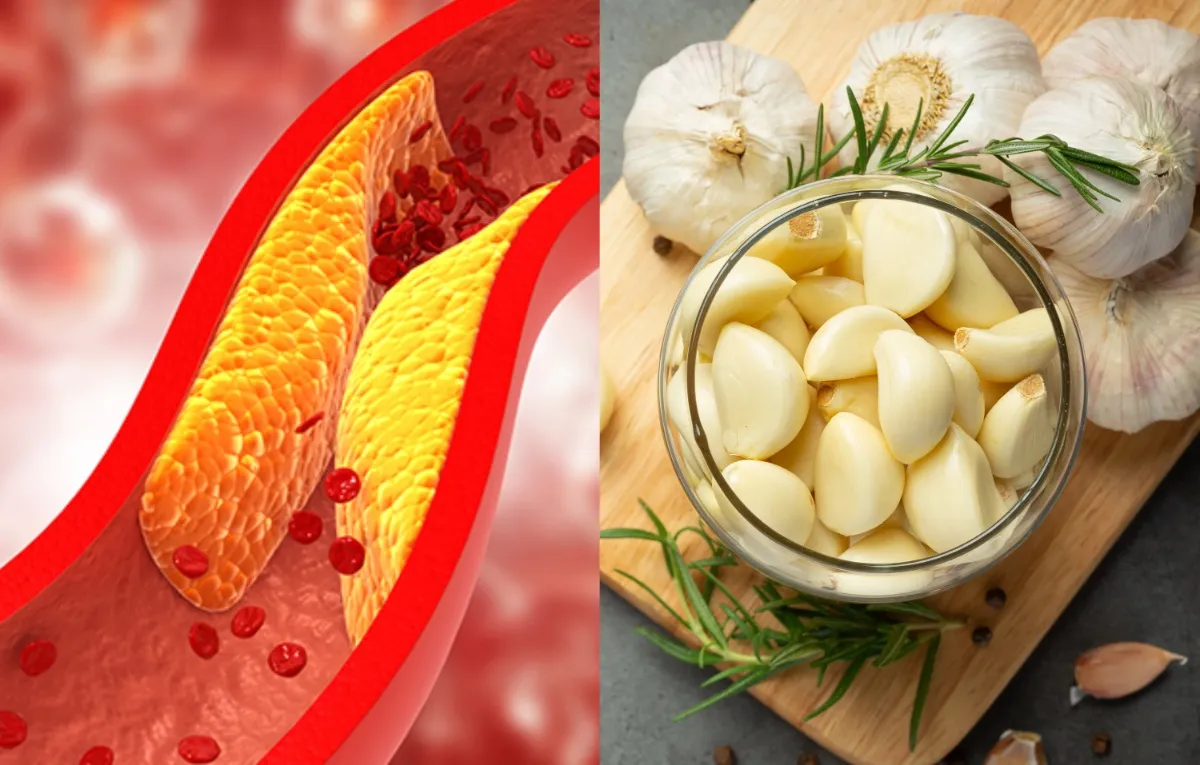 Garlic control cholesterol- India TV Hindi