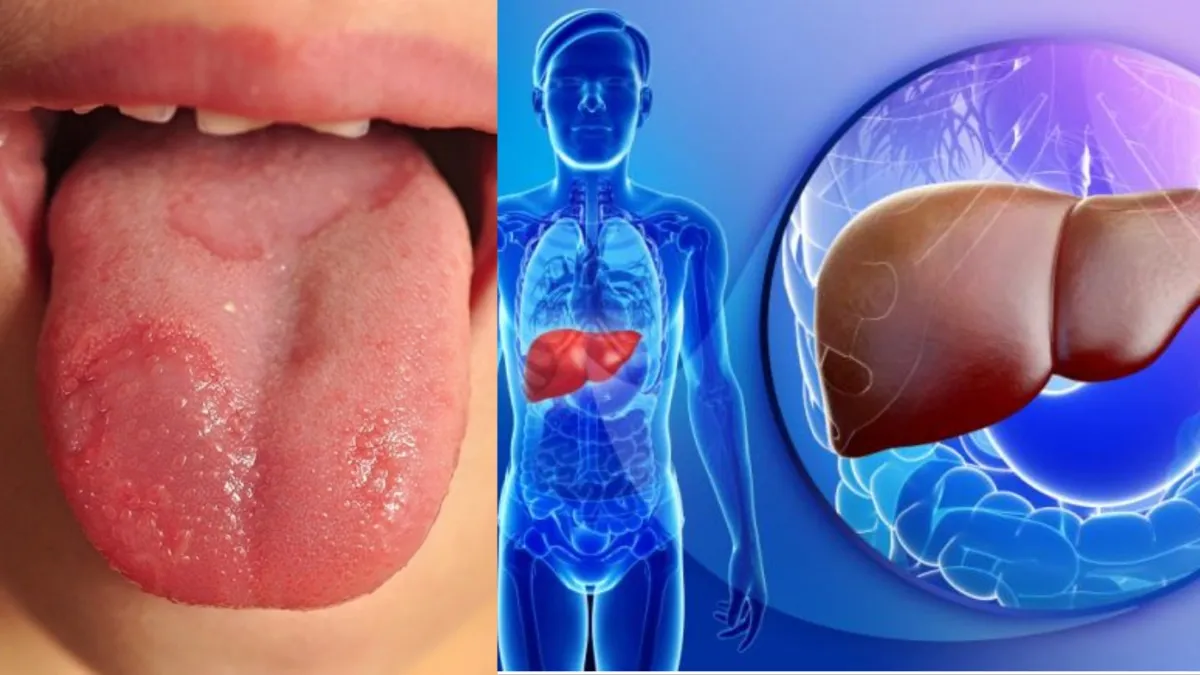 liver heats up symptoms- India TV Hindi
