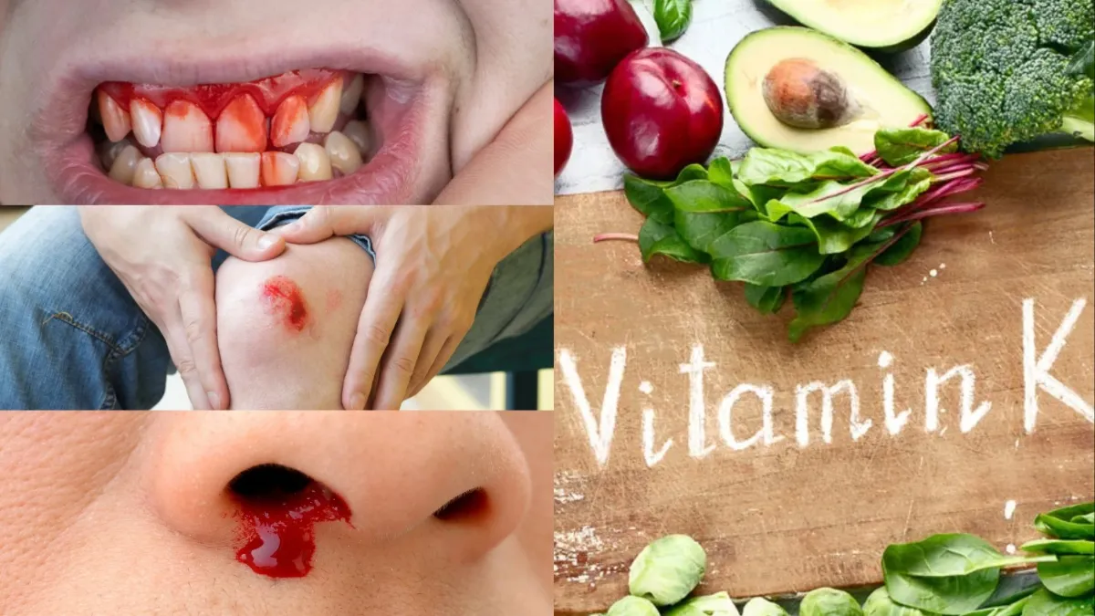 Vitamin k Deficiency - India TV Hindi