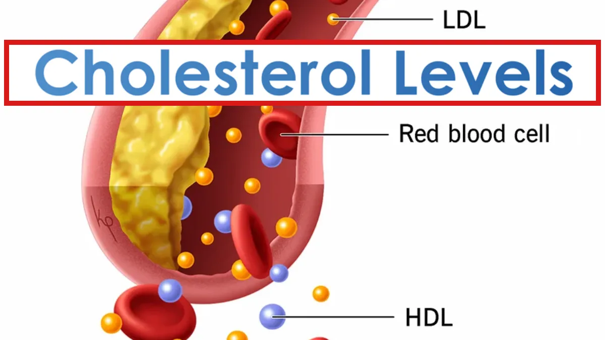 Cholesterol Level- India TV Hindi