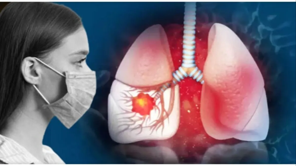 White lung syndrome symptoms,- India TV Hindi