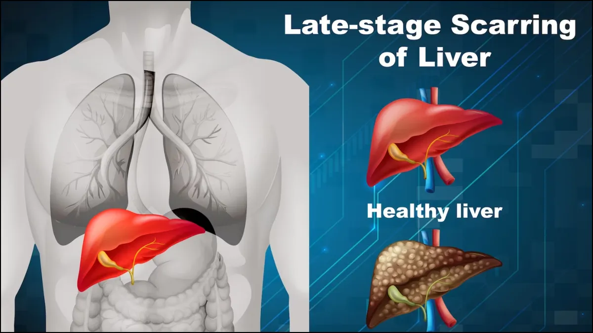 Liver Health- India TV Hindi
