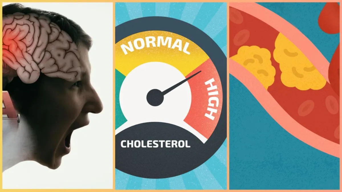 cause of sudden increase in cholesterol levels- India TV Hindi