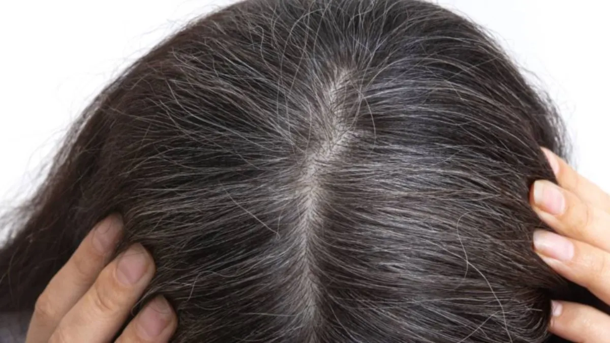 Get rid of gray hair with home remedy - India TV Hindi