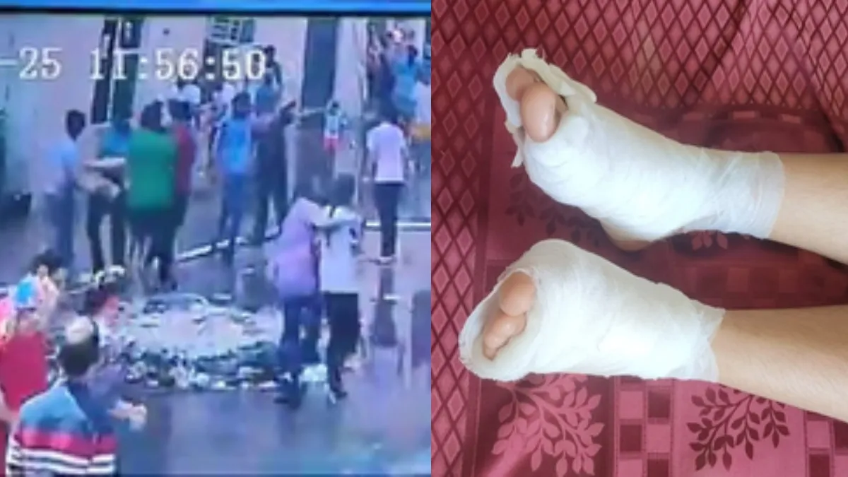 बच्चे का दोनों पैर बुरी तरह जल गया- India TV Hindi