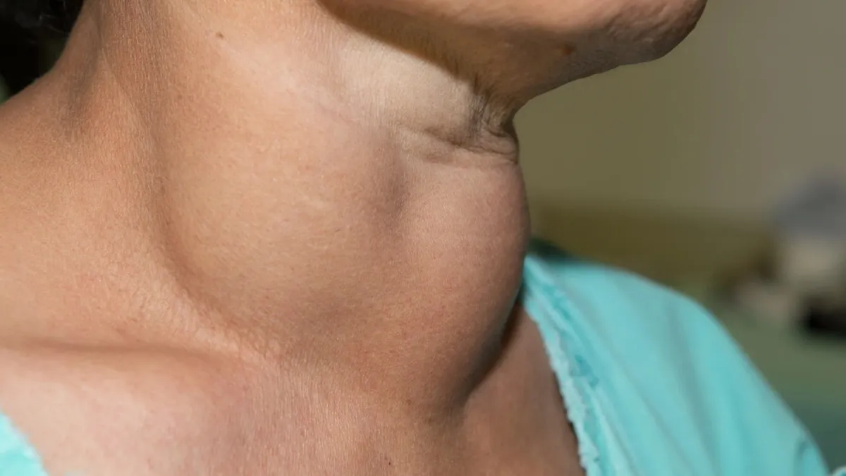 Thyroid causes, symptoms and prevention- India TV Hindi