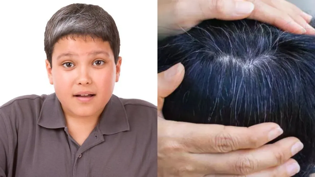 कम उम्र में बालों का पकना कैसे रोके - India TV Hindi