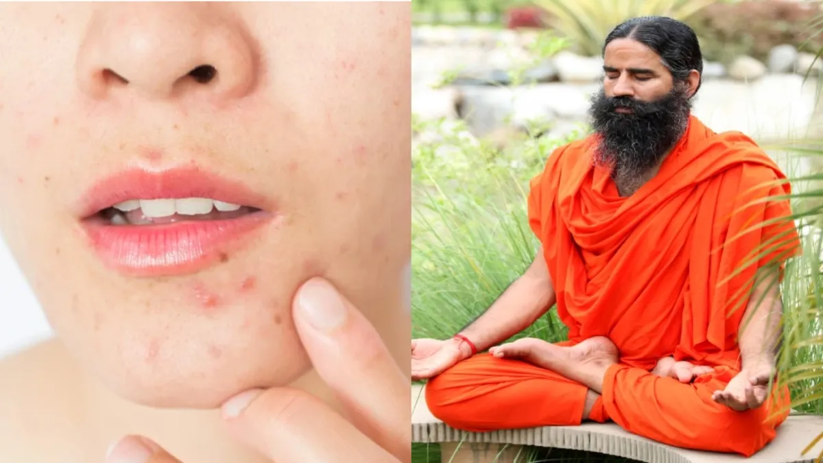 Skin Care Tips In Monsoon From Baba Ramdev- India TV Hindi