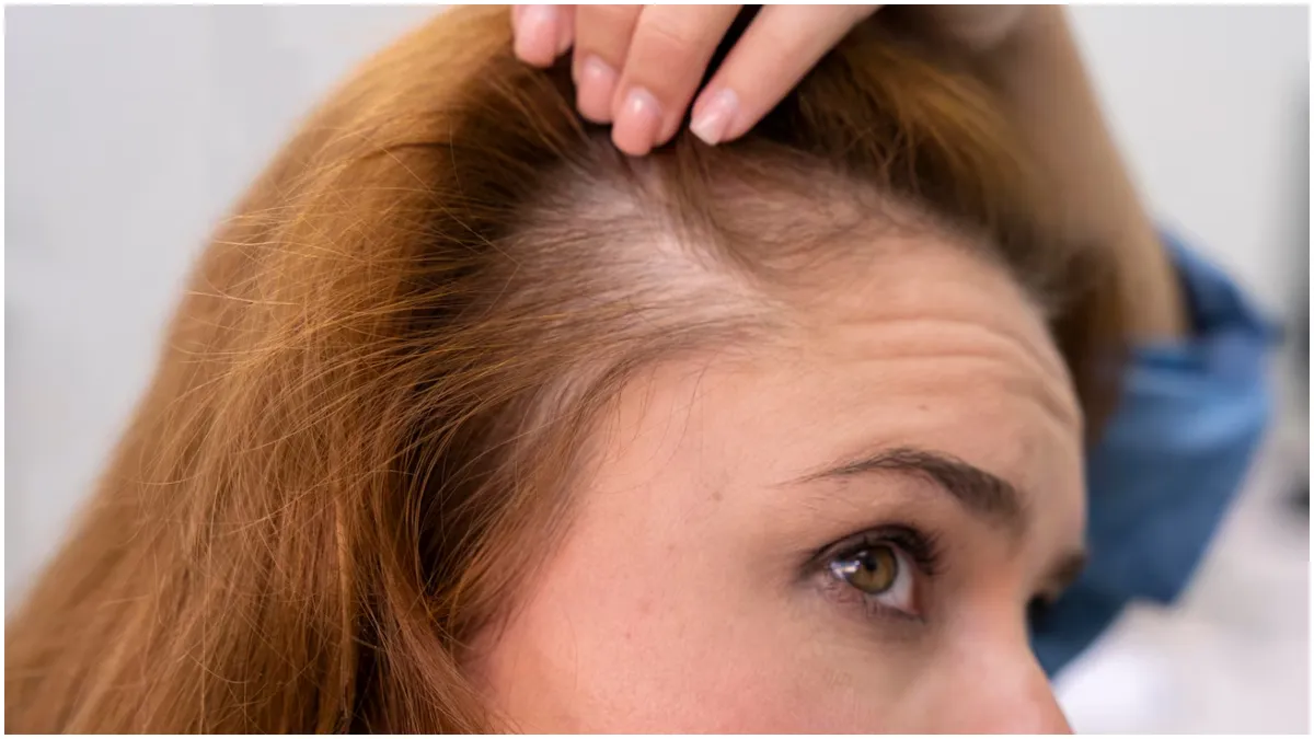 How to get rid of hair fall problem?- India TV Hindi