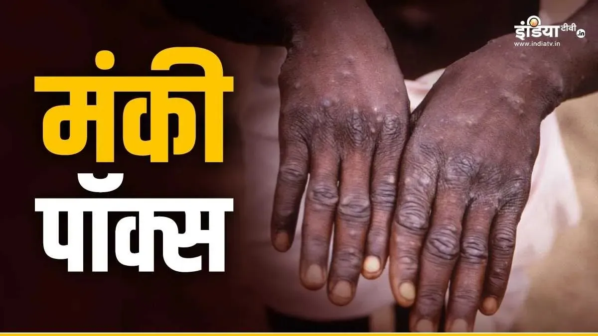 Monkey pox- India TV Hindi