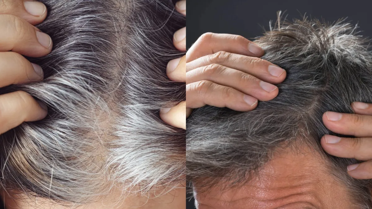 how to control grey hair at home- India TV Hindi