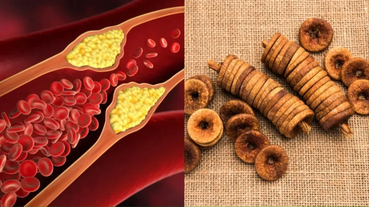 cholesterol - India TV Hindi