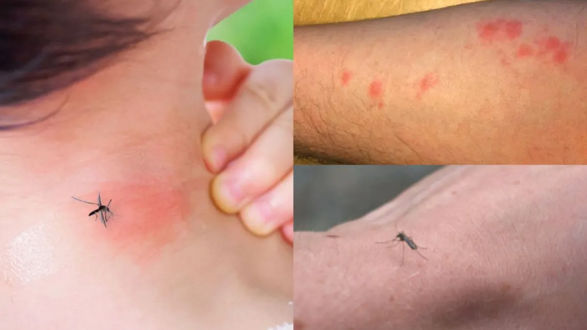 home remedy to get rid of mosquitoes- India TV Hindi