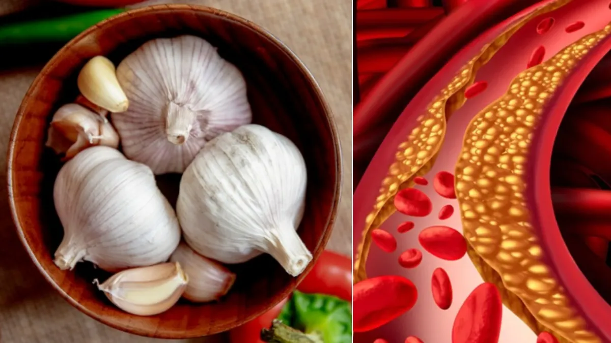 कच्चे लहसुन के फायदे- India TV Hindi