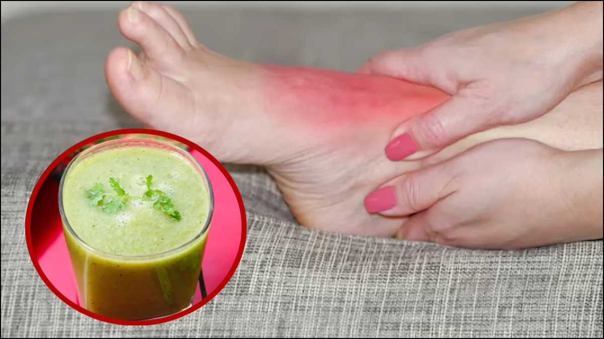 Como controlar o ácido úrico