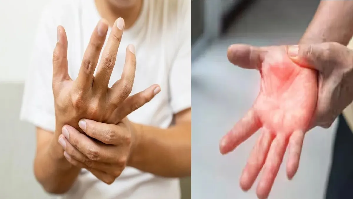 Guillain Barre syndrome 
