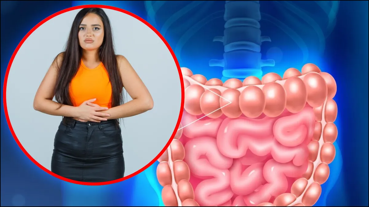     Inchaço intestino 