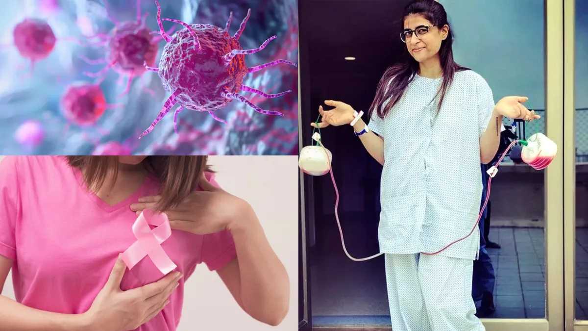 Breast cancer recurrence- India TV Hindi