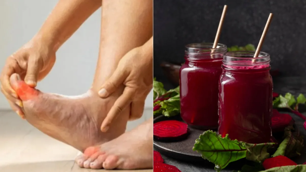 हाई यूरिक एसिड के लिए जूस
