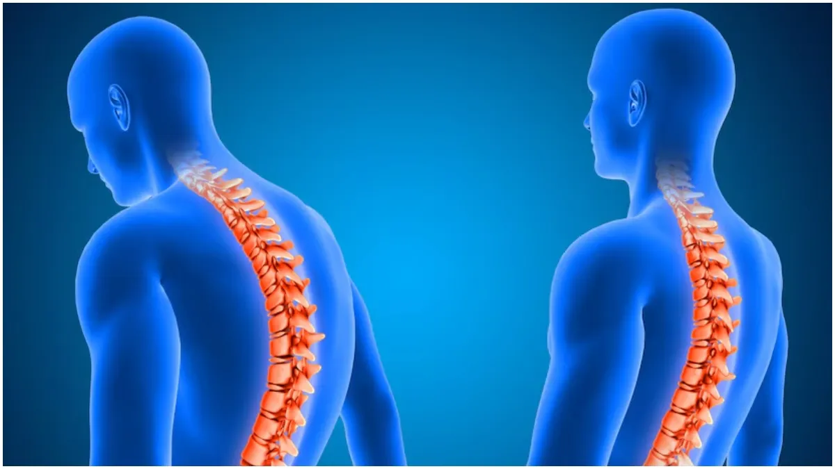 स्पाइन प्रॉब्लम का इलाज- India TV Hindi