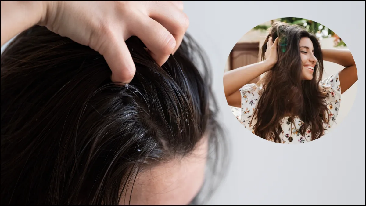How to make scalp healthy