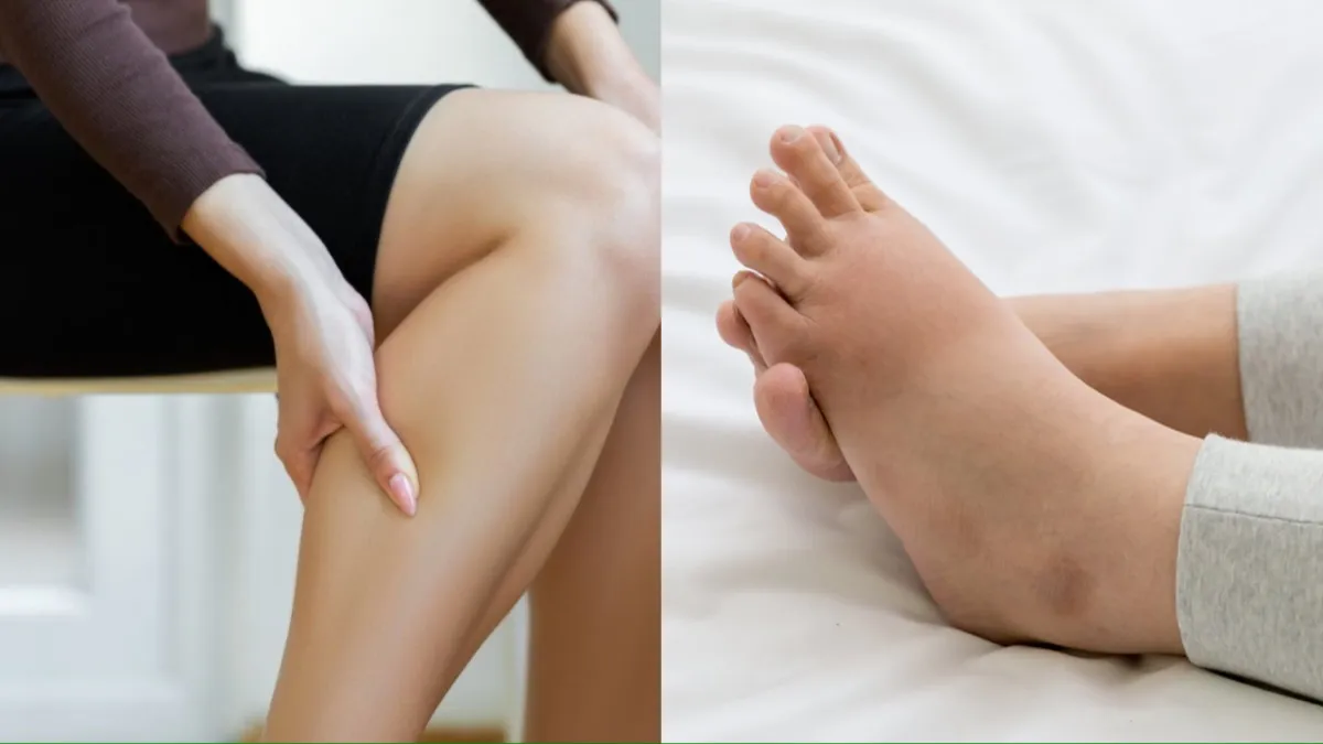 क्या है वाटर रिटेंशन- India TV Hindi