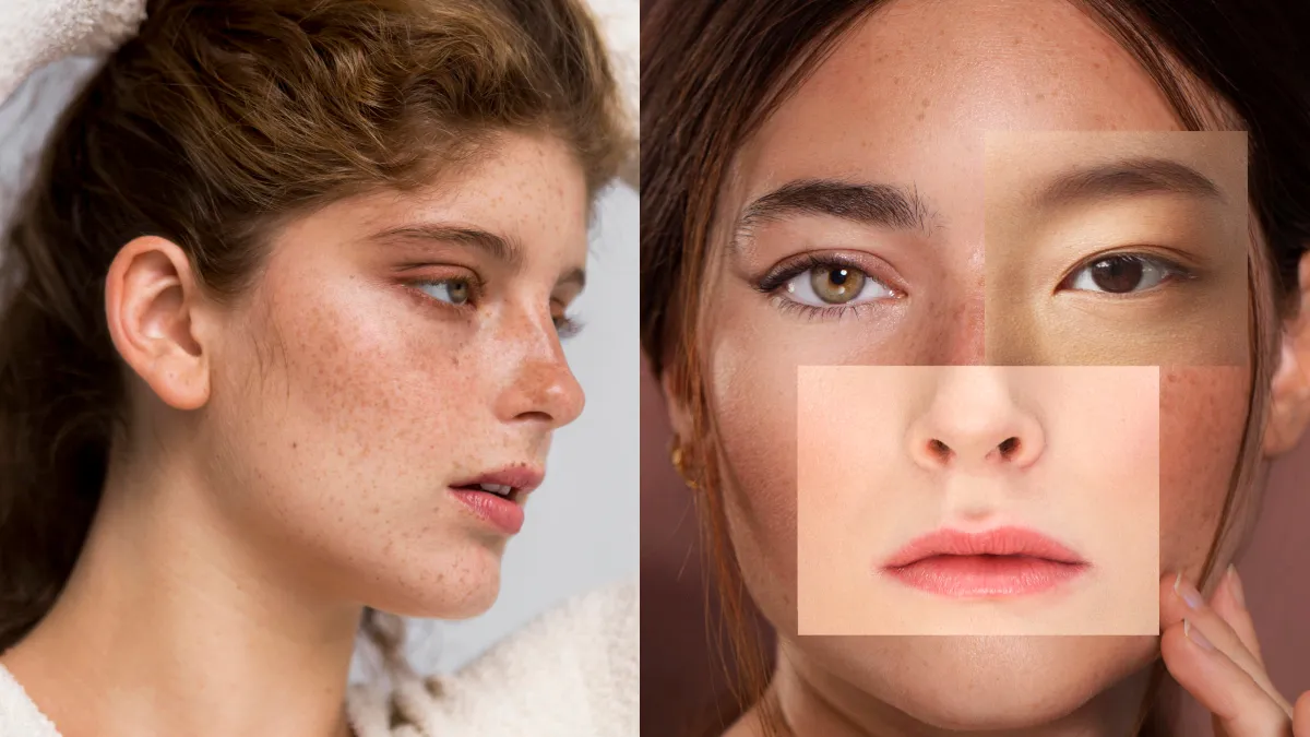 Measures to remove freckles