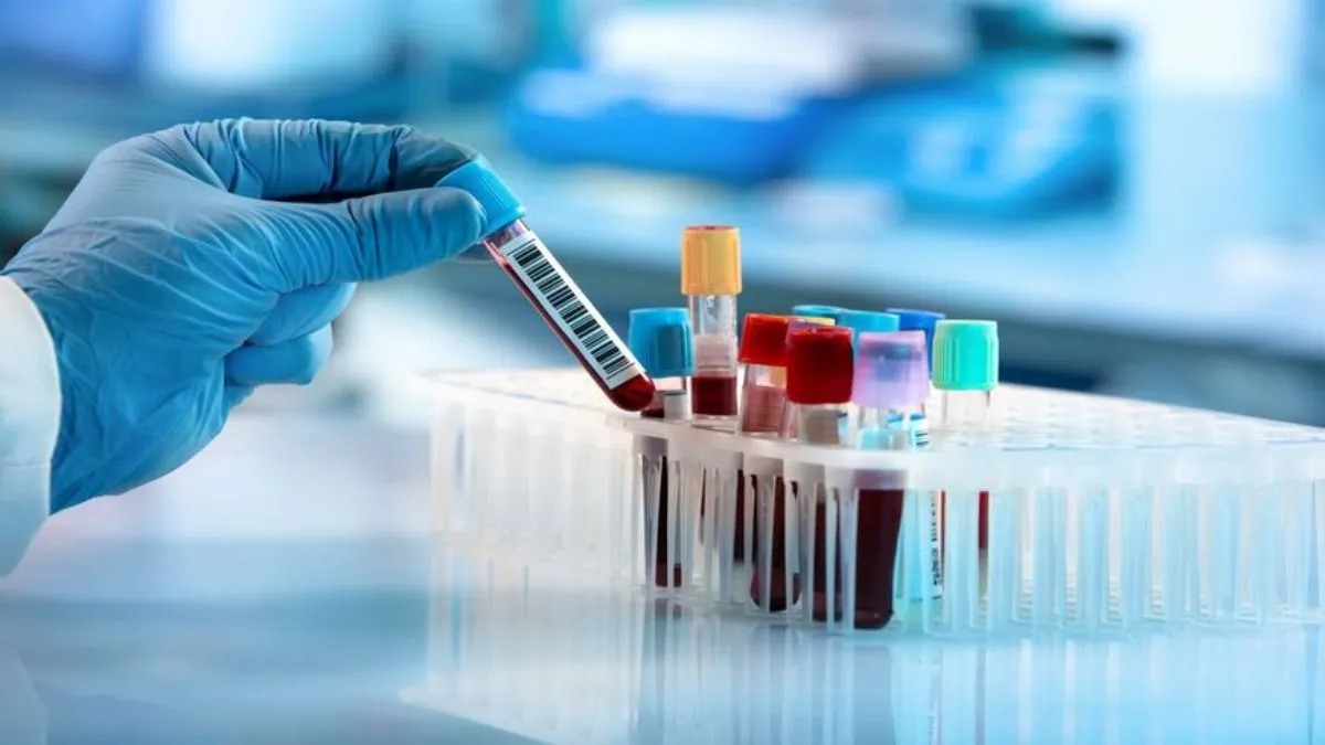 Labs 