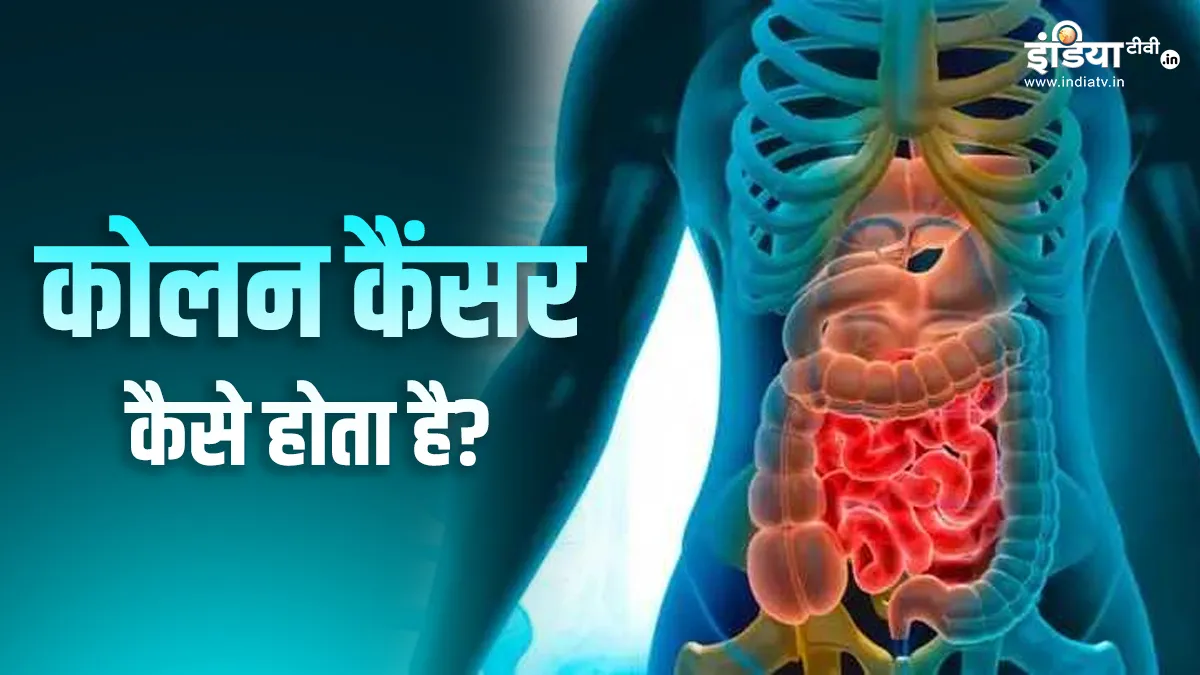 कोलन कैंसर- India TV Hindi