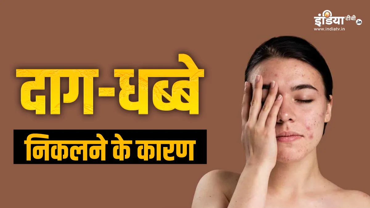 दाग-धब्बों का कारण