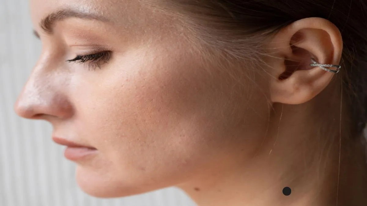 Lucky mole- India TV Hindi