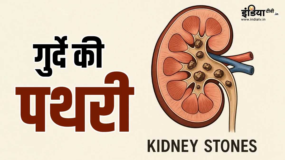 पथरी के कारण- India TV Hindi