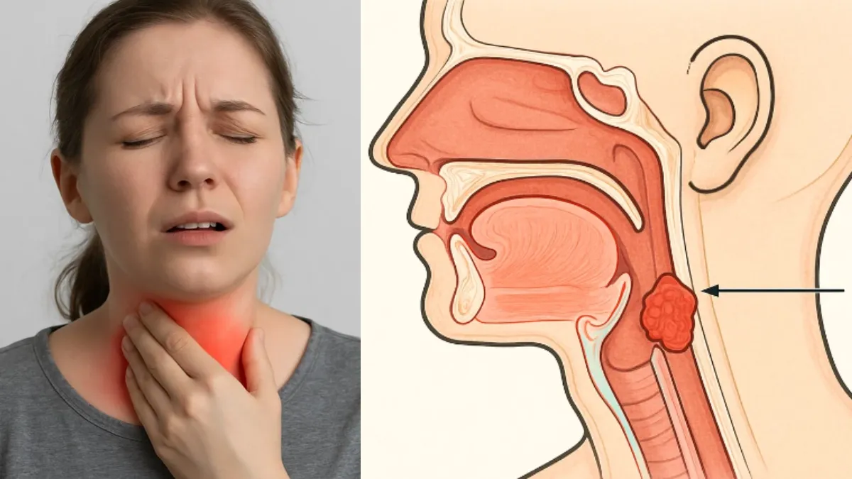 थ्रोट कैंसर- India TV Hindi