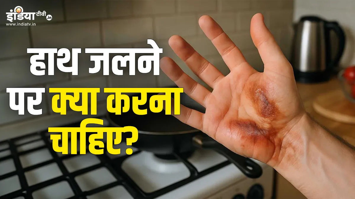 Follow these home remedies when skin burns
