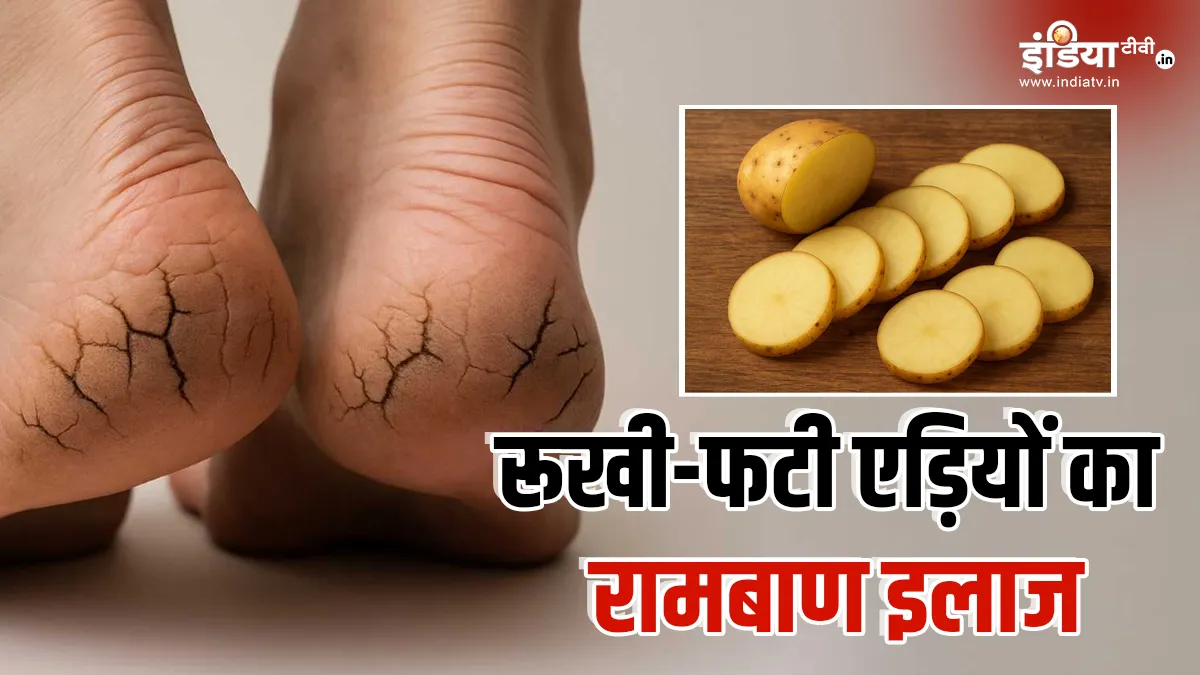 Potatoes can get rid of torn ankles